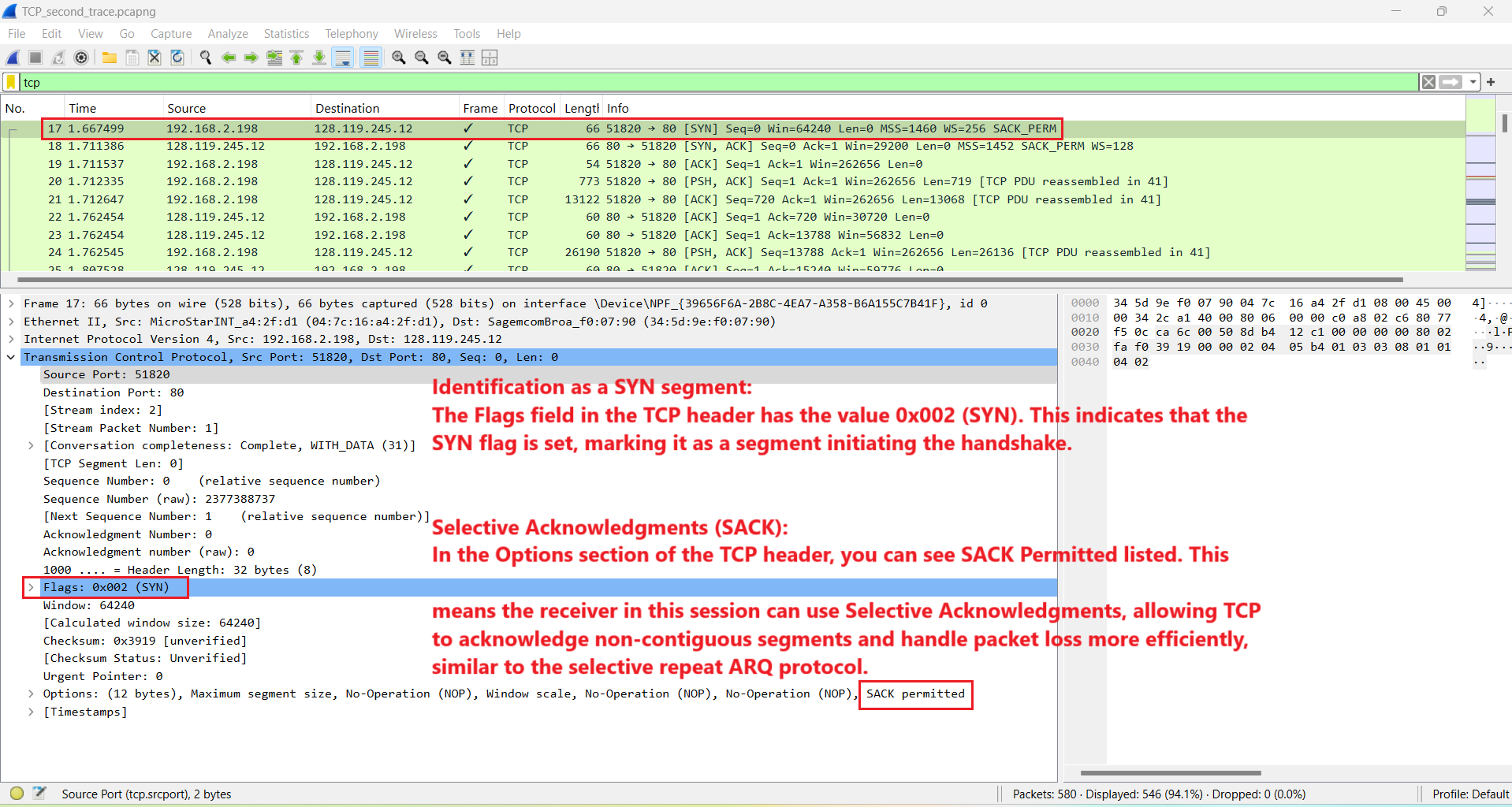 TCP SYN segment showing flags and SACK option